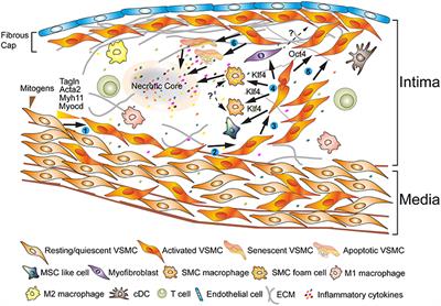 Vascular Smooth Muscle Cells Contribute to Atherosclerosis Immunity